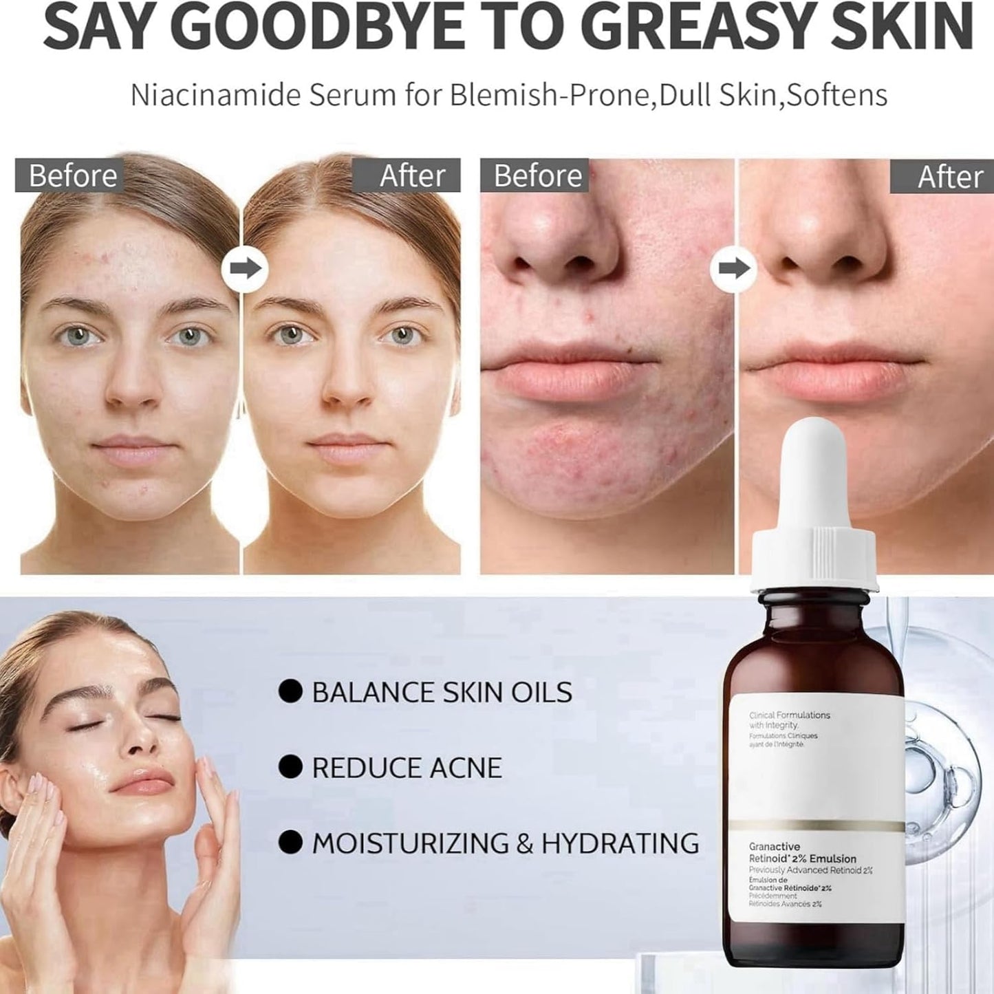 Retinoid 2% Emulsion Retinol Serum