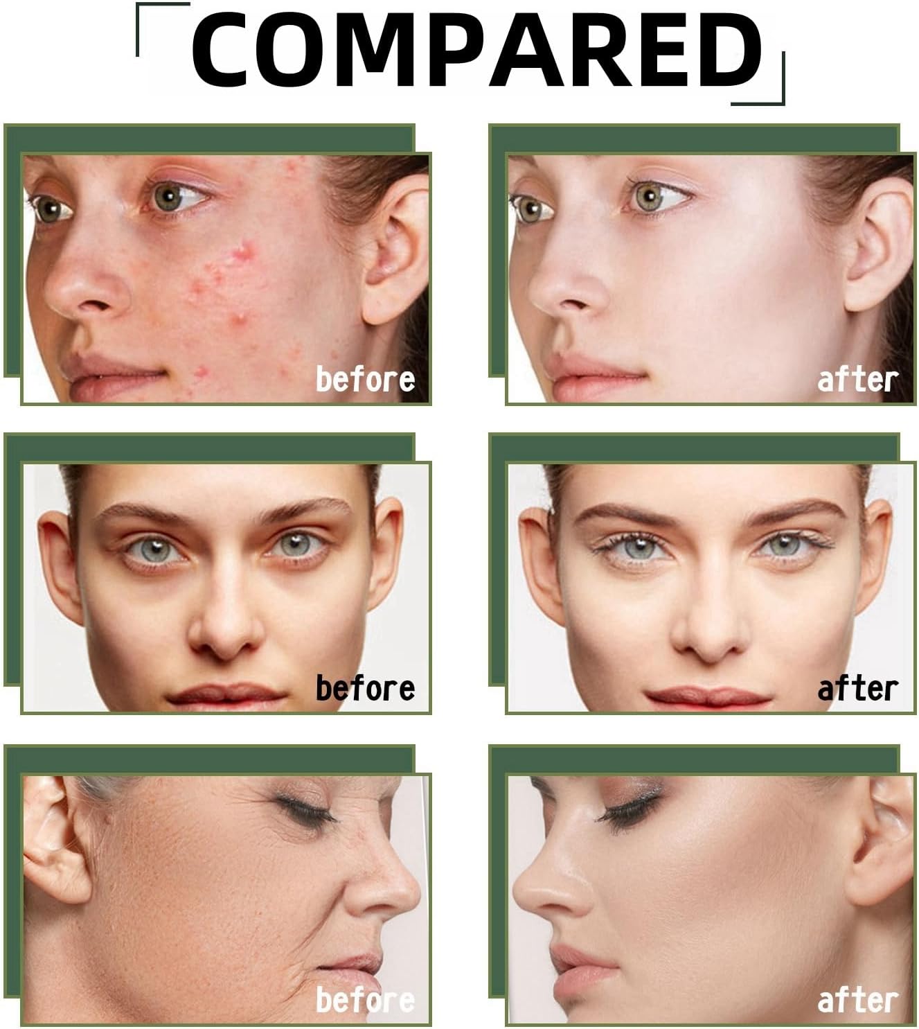 Alpha Arbutin 2% + Hyaluronic Acid