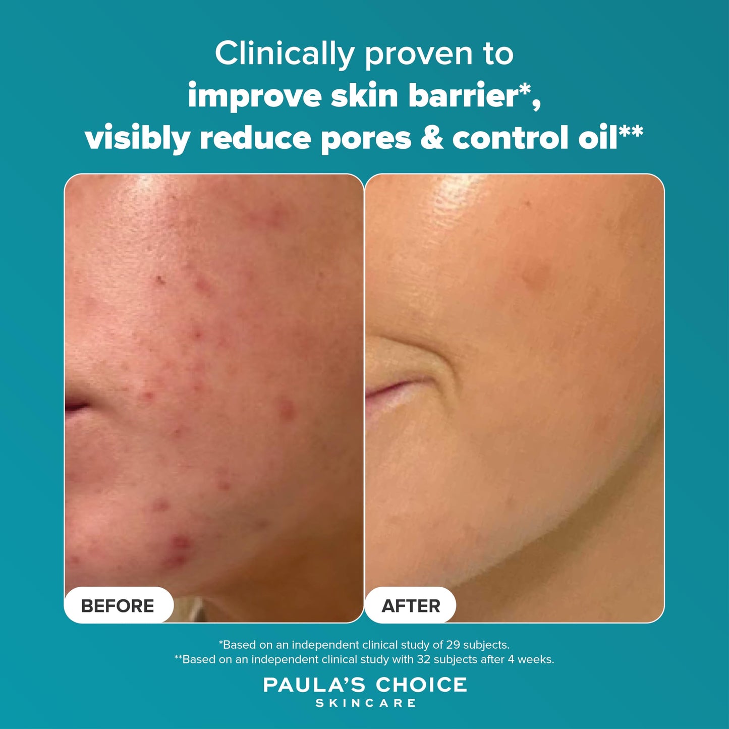 Paula's Choice SKIN PERFECTING 2% BHA Liquid Exfoliant