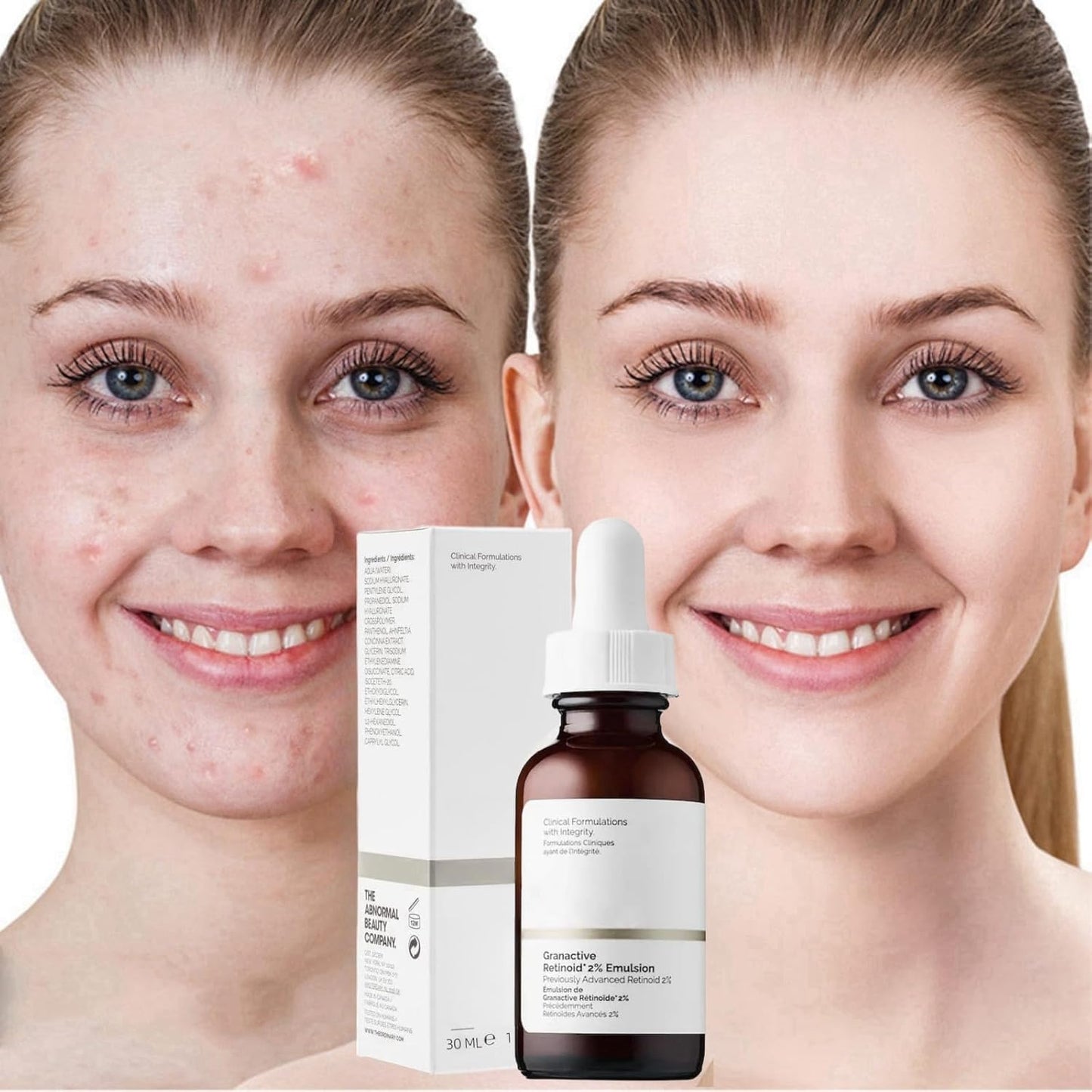Retinoid 2% Emulsion Retinol Serum