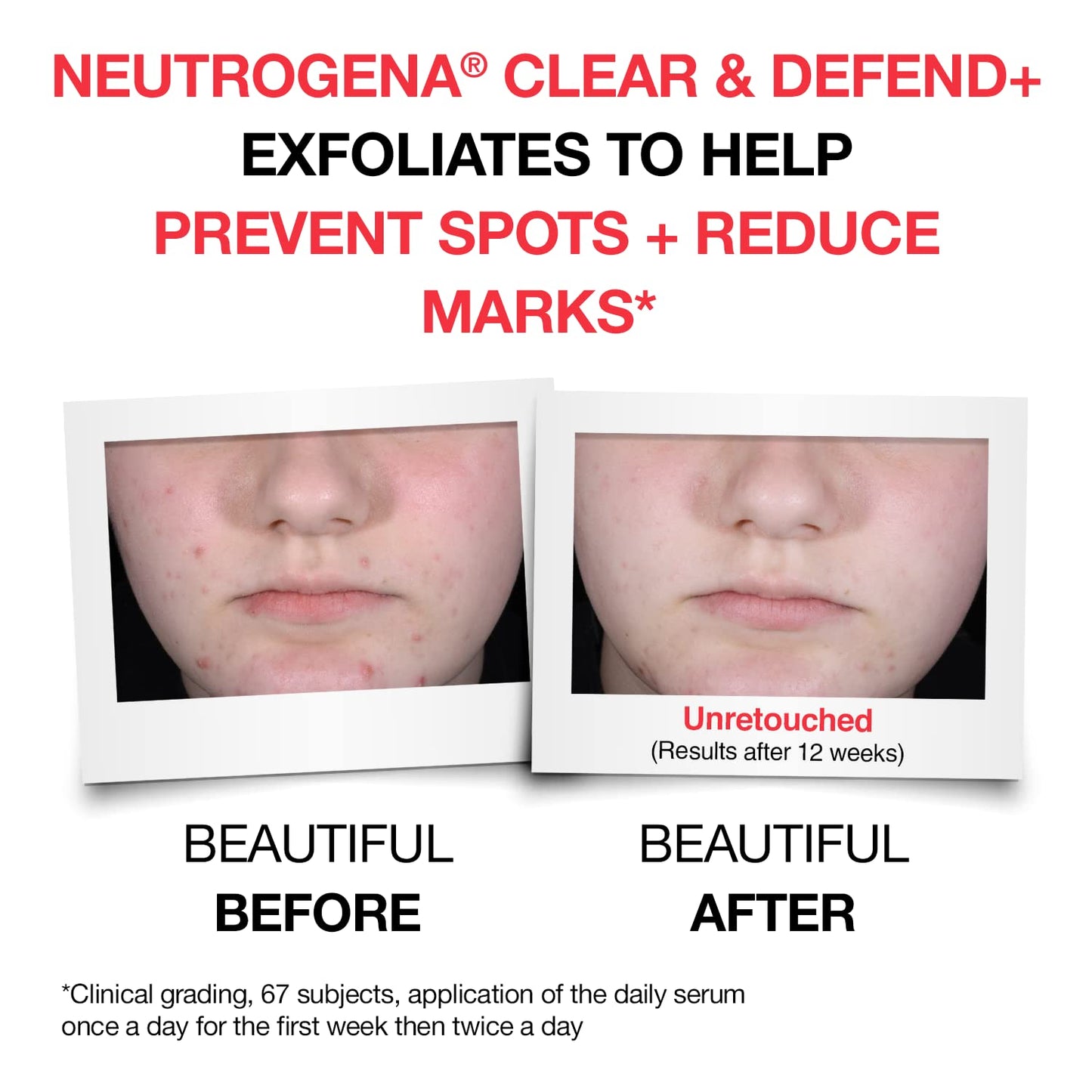 Neutrogena Clear & Defend+ Face Wash