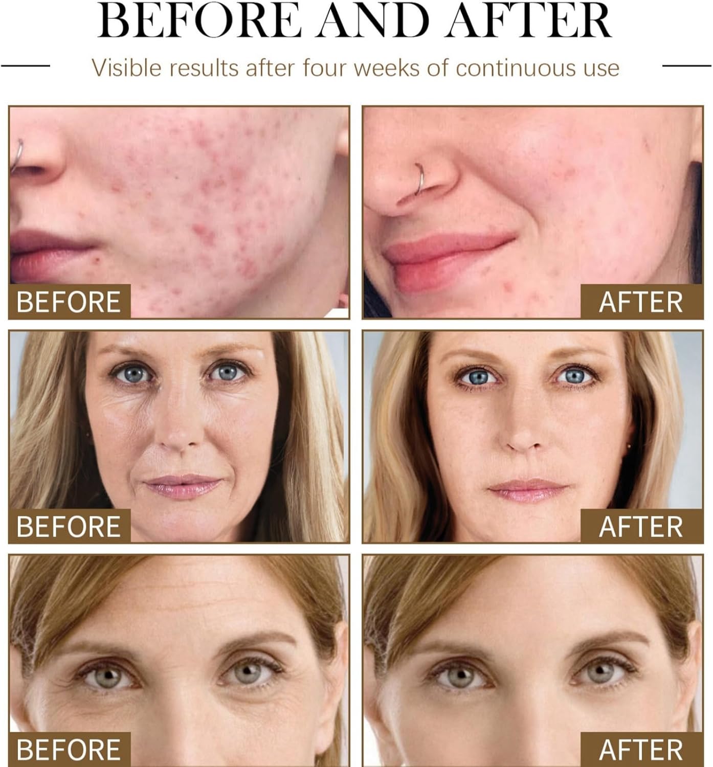 Lactic Acid 10% + Hialuronyc Acid 10% Exfoliating Serum
