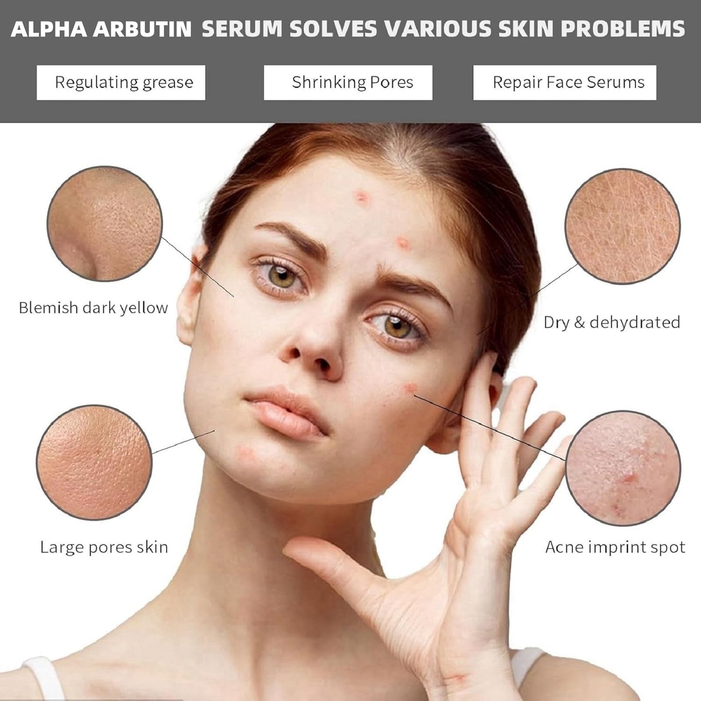 Alpha Arbutin 2% + Hyaluronic Acid