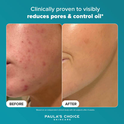 Paula's Choice SKIN PERFECTING 2% BHA Liquid Exfoliant