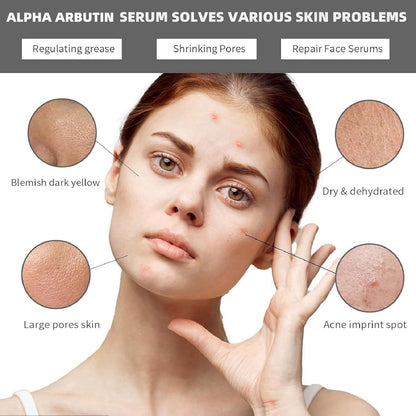 Alpha Arbutin 2% + Hyaluronic Acid